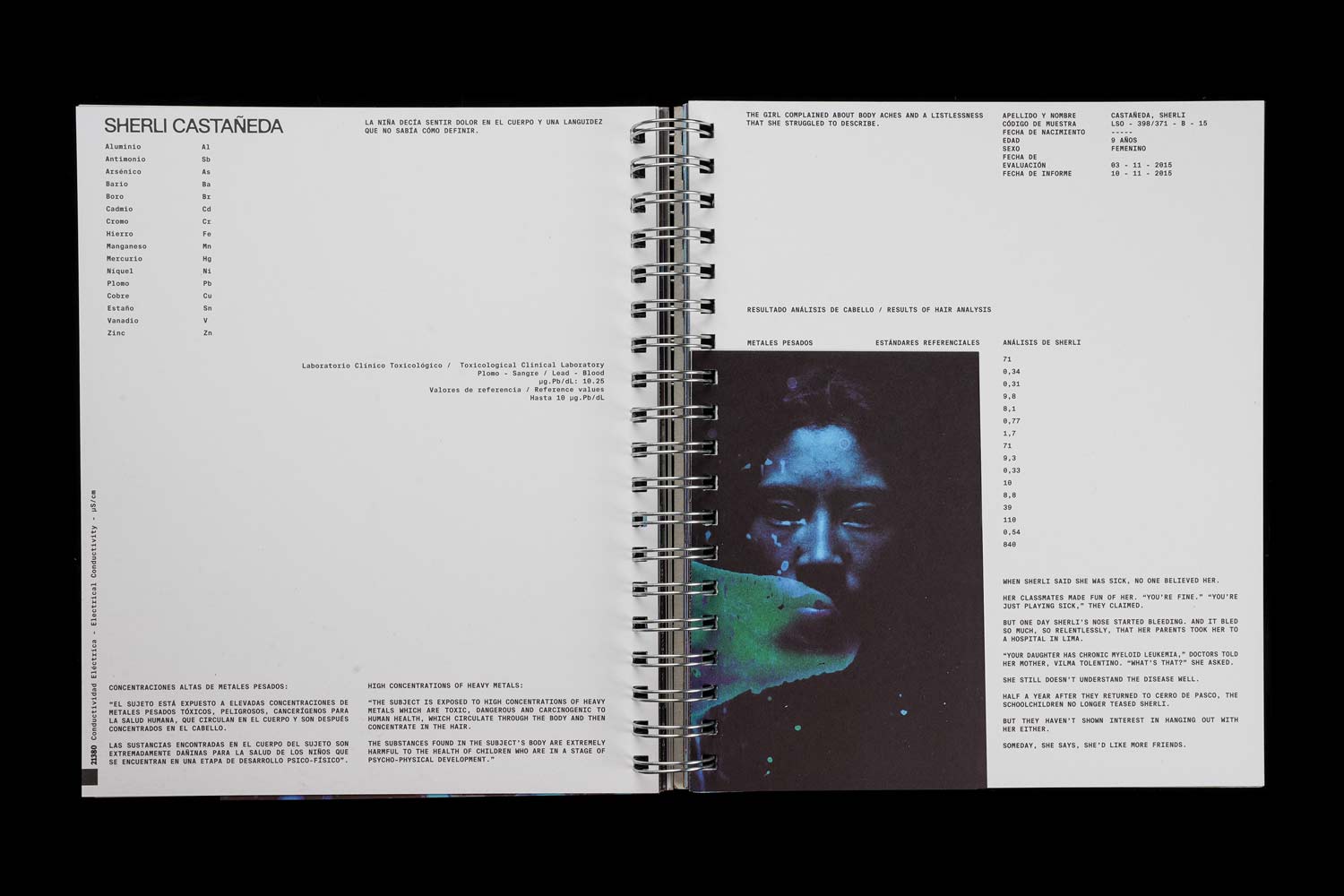 Marco Garro - Quiulacocha