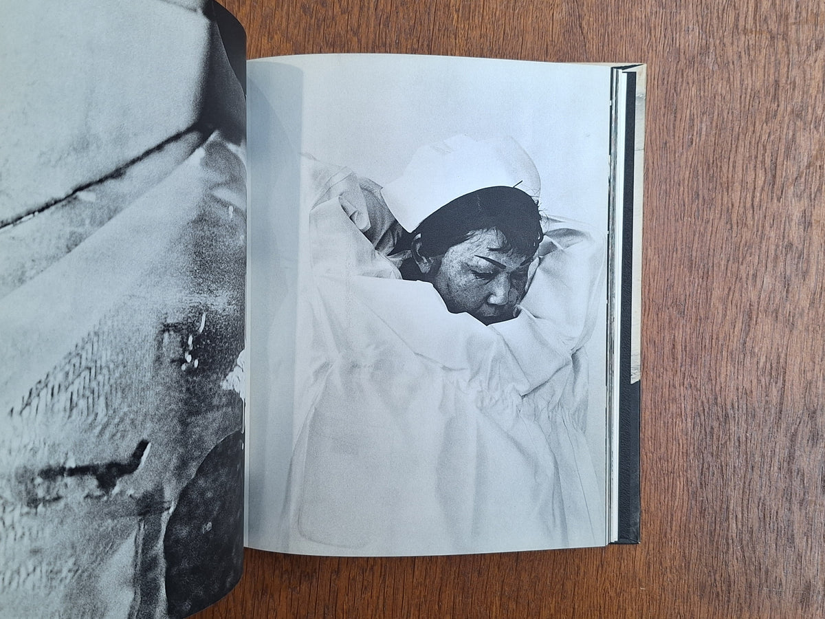 Shomei Tomatsu - <11：02> Nagasaki