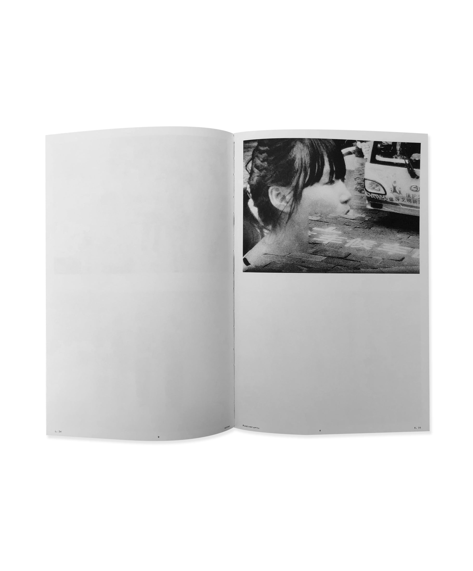 SIMON VANSTEENWINCKEL - WUHAN RADIOGRAPHY